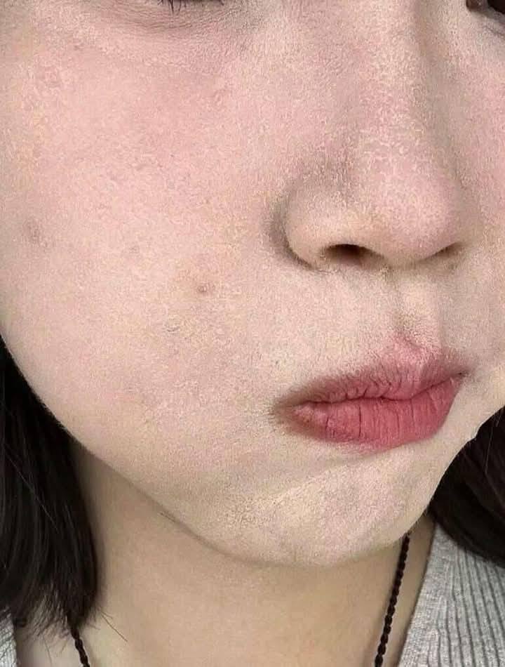 Igari Makeup là gì mà khiến gương mặt như 'say rượu vẫn xinh đẹp" đánh nền bị mốc